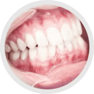 Distanza di lavoro personalizzata 3.0X