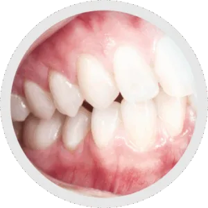 Distanza di lavoro personalizzata 5.3X