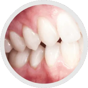 Distanza di lavoro personalizzata 7.4X